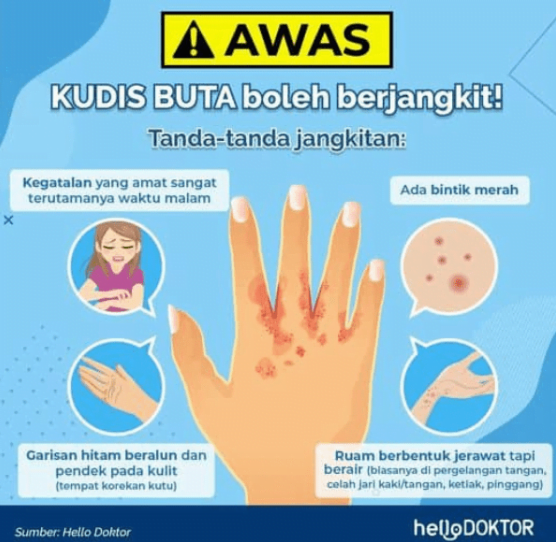 kudis buta