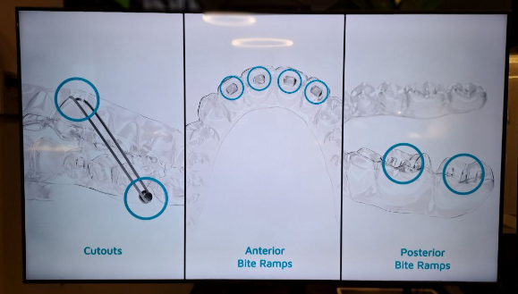 STRAUMANN RAI TUJUH DEKAD INOVASI PERGIGIAN